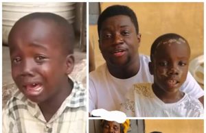 Viral meme boy Albert Nketia battles skin infection