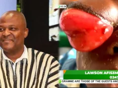 The doctors said we should bring money for surgery but we don’t have it- parents of 3-year-old child battling an eye problem cry as they beg Ibrahim Mahama for help