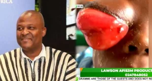 The doctors said we should bring money for surgery but we don’t have it- parents of 3-year-old child battling an eye problem cry as they beg Ibrahim Mahama for help