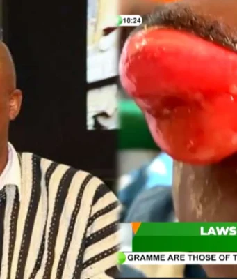 The doctors said we should bring money for surgery but we don’t have it- parents of 3-year-old child battling an eye problem cry as they beg Ibrahim Mahama for help