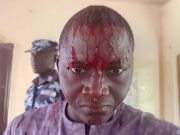 West Africa Editors Society condemns Bauchi State police unprovoked assault on journalist Mohammed Adamu