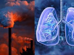 Air Pollution responsible for a third of stroke, lung cancer and neonatal deaths in Ghana — 2025 SoGA Report