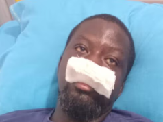 Artiste Ibrahim Mahama alleges assault by police special operations team in Tamale