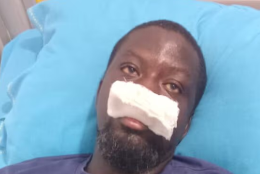 Artiste Ibrahim Mahama alleges assault by police special operations team in Tamale