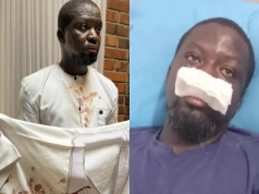 Police Transfer Ibrahim Mahama assault probe to CID Headquarters