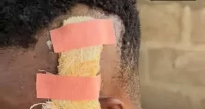 Lady injures ex-partner after separation