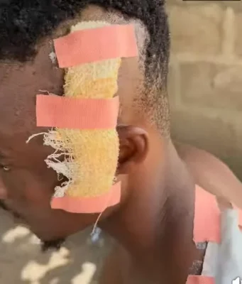 Lady injures ex-partner after separation