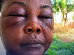 GH woman gets assaulted over a man