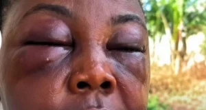 GH woman gets assaulted over a man