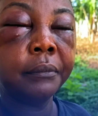 GH woman gets assaulted over a man