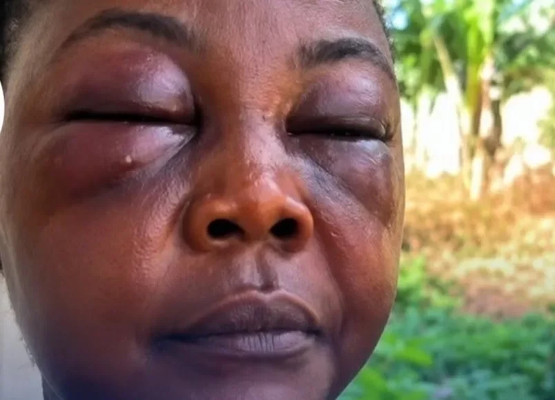 Assaulted-Ghanaian-Woman.webp