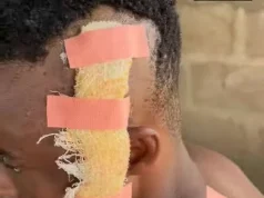Lady injures ex-partner after separation