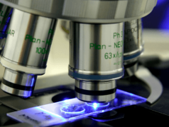 Ghana struggles to achieve nationwide newborn screening for sickle cell