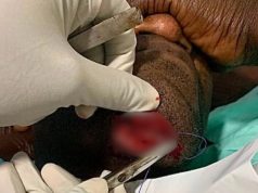 Kenpong suffers serious injuries after freak domestic accident