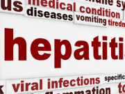 Four million Ghanaians living with Hepatitis