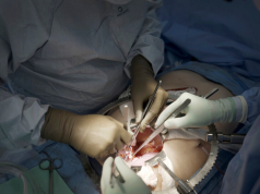 Nearly one in five Ghanaians may be living with chronic kidney disease as cases surge nationwide