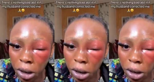 Lady defends her husband for beating her