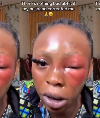 Lady defends her husband for beating her