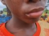 Mysterious illness leaves children struggling to walk, hear as Mafi Kope community appeals for urgent medical help