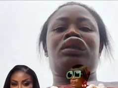 Video of Nana Akua Addo assaulted and receiving treatment at the hospital