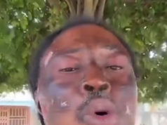 Kwaku Bonsam appeals to Mahama, Ablakwa to facilitate his US travel for skin graft; says he’ll fund it